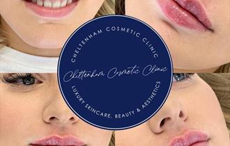 Cheltenham Cosmetic Clinic