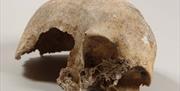 Image of skull found at Pant y Wennol on display at Llandudno Museum