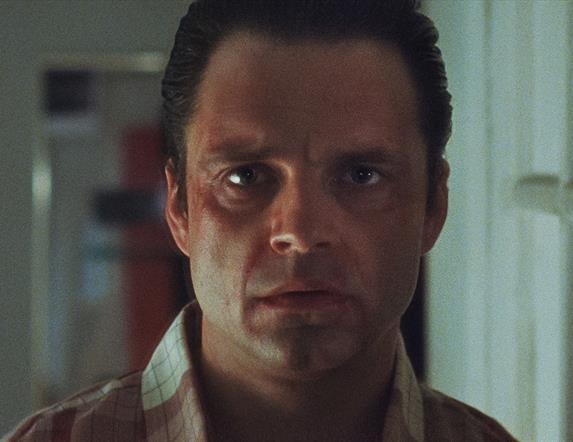 Man with facial deformity staring ahead