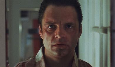 Man with facial deformity staring ahead