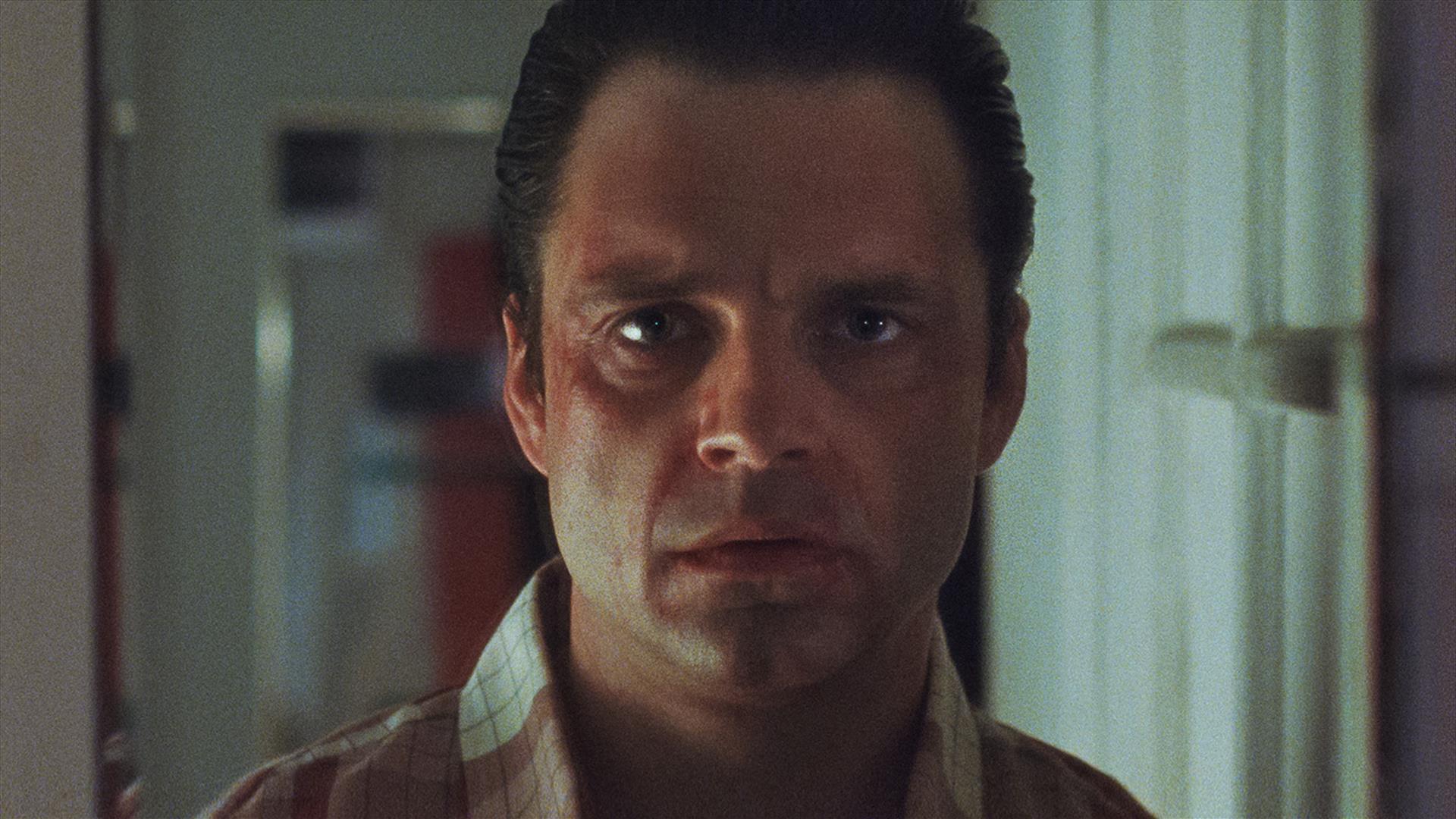 Man with facial deformity staring ahead