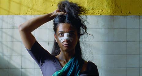 woman staring ahead with bandage on her nose