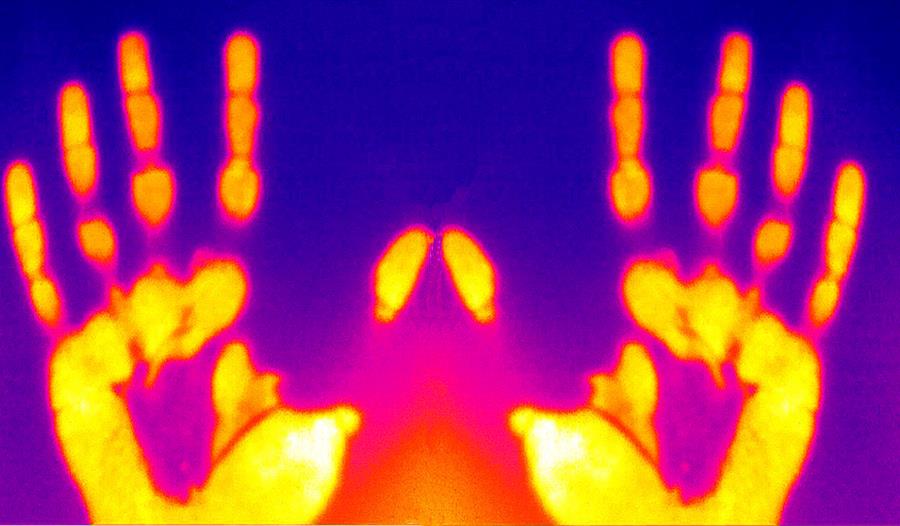 colour thermal image with yellow hands against pink and purple background.