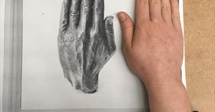 Eleanor Duffin: A Phantom Limb