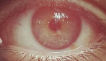 Close-up of an eyeball with a sepia-like filter