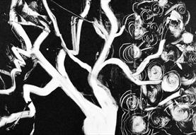 The Oak Tree - Reconnecting to Nature